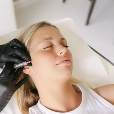 Skinvive vs dermal fillers: Which is right for you?