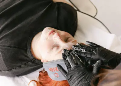 The most effective ways to treat rosacea-prone skin