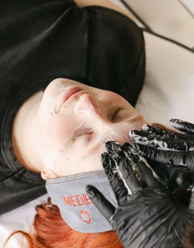 The most effective ways to treat rosacea-prone skin