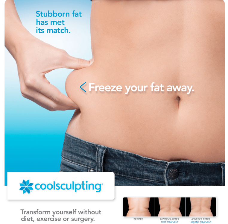 CoolSculpting in and around Maidstone