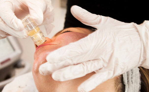 The Aquagold Facial: Everything you need to know about microinfusions