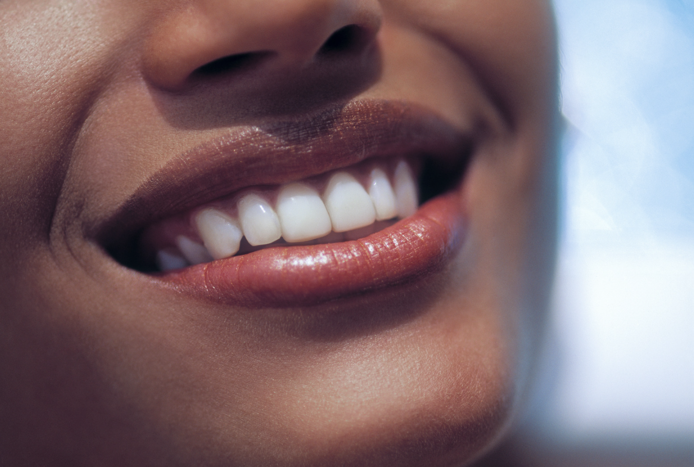 What causes a gummy smile and how can you correct it?
