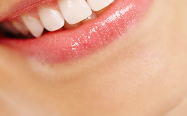 What causes a gummy smile and how can you correct it?